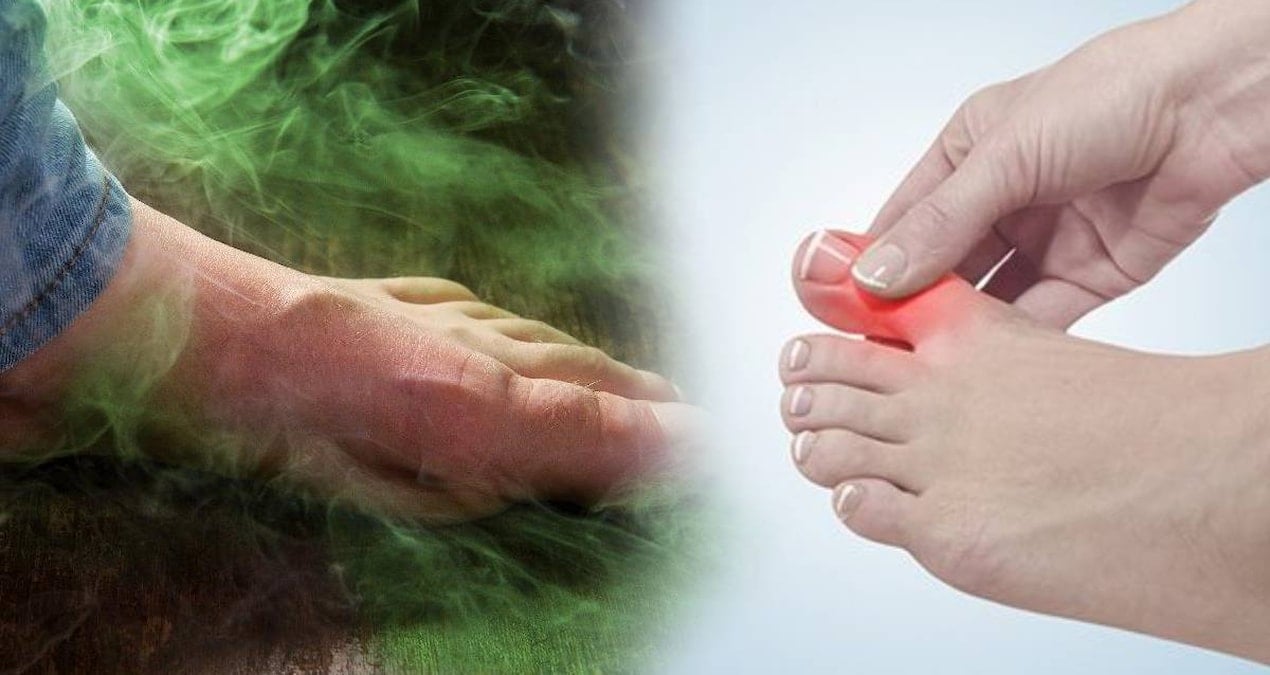 ayak mantarinin kokunu kurutuyor 2 malzeme yetiyor kokudan eser kalmiyor Y9vsbXjT