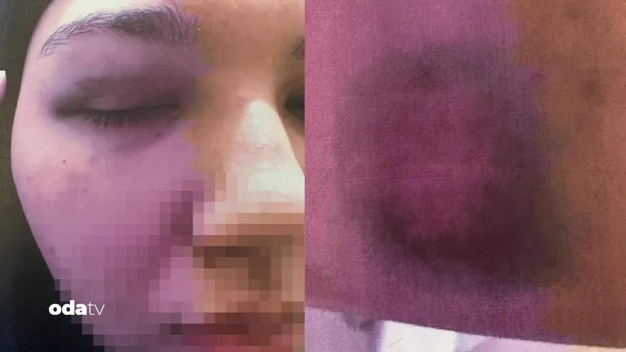 beyoglunda anne kiza bitmeyen siddet hem cinsel hem fiziki UWKz8EB9