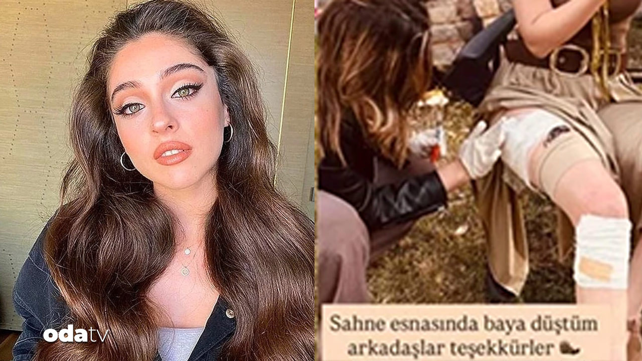 cemre bayselin bacaklari yara icinde kaldi sette talihsiz kaza bQ7zLctQ