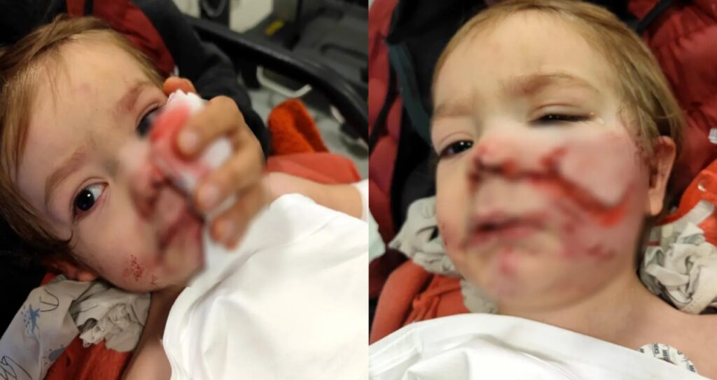 Pitbull saldırısına uğrayan minik Efe’den haber var!